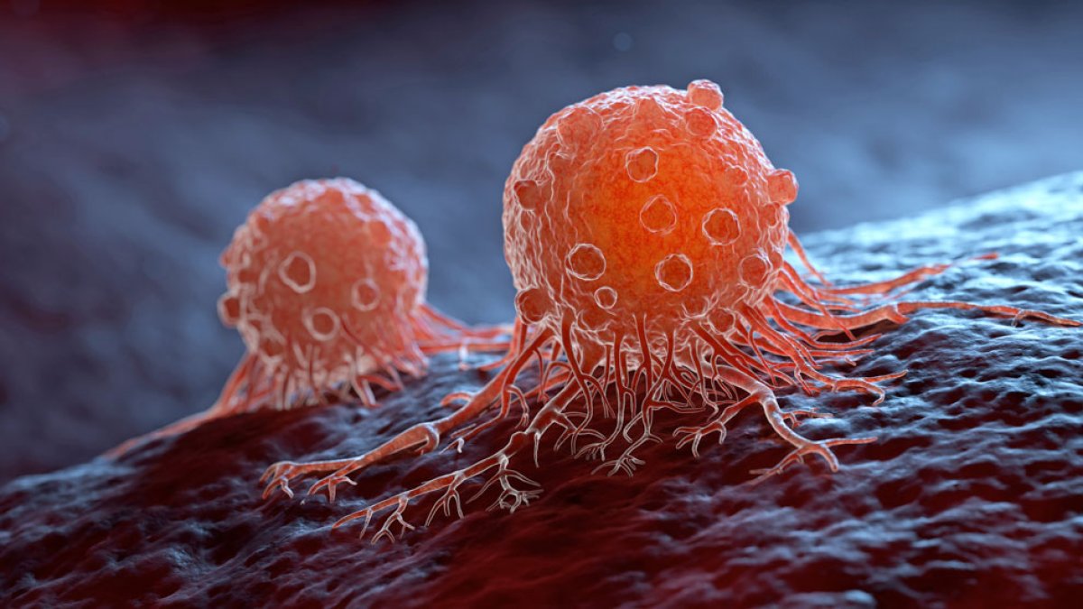 Asco 2026: Los ensayos más prometedores contra el cáncer