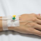 Los pacientes suelen sufrir largos retrasos diagnósticos o diagnósticos erróneos.