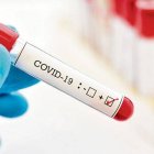 Pruebas COVID-19 (Fuente externa)