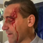 El sacerdote Johnny Durán, resultó herido mientras protestaba contra el desalojo forzoso de la empresa Barrick Pueblo Viejo.