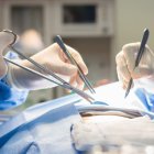 Foto de referencia de una cirugía