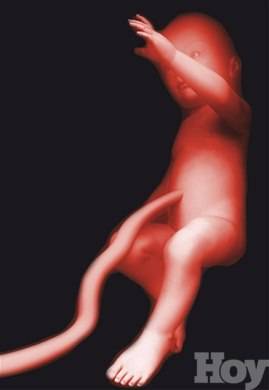 ¿Qué nos dice el <BR>cordón umbilical?