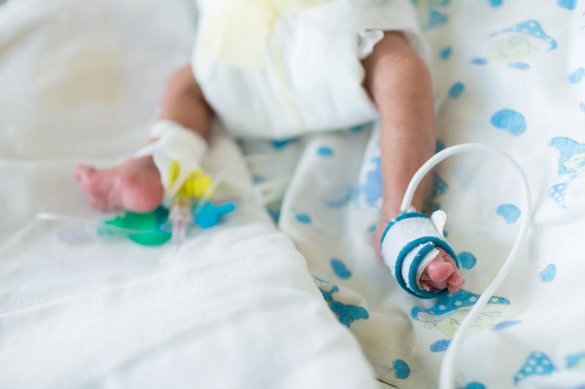 Neonato