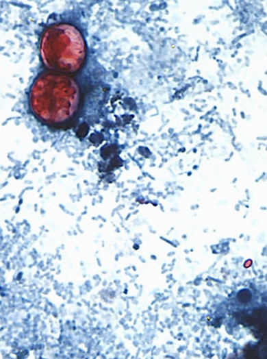 Quistes de Cyclosplora.  AP